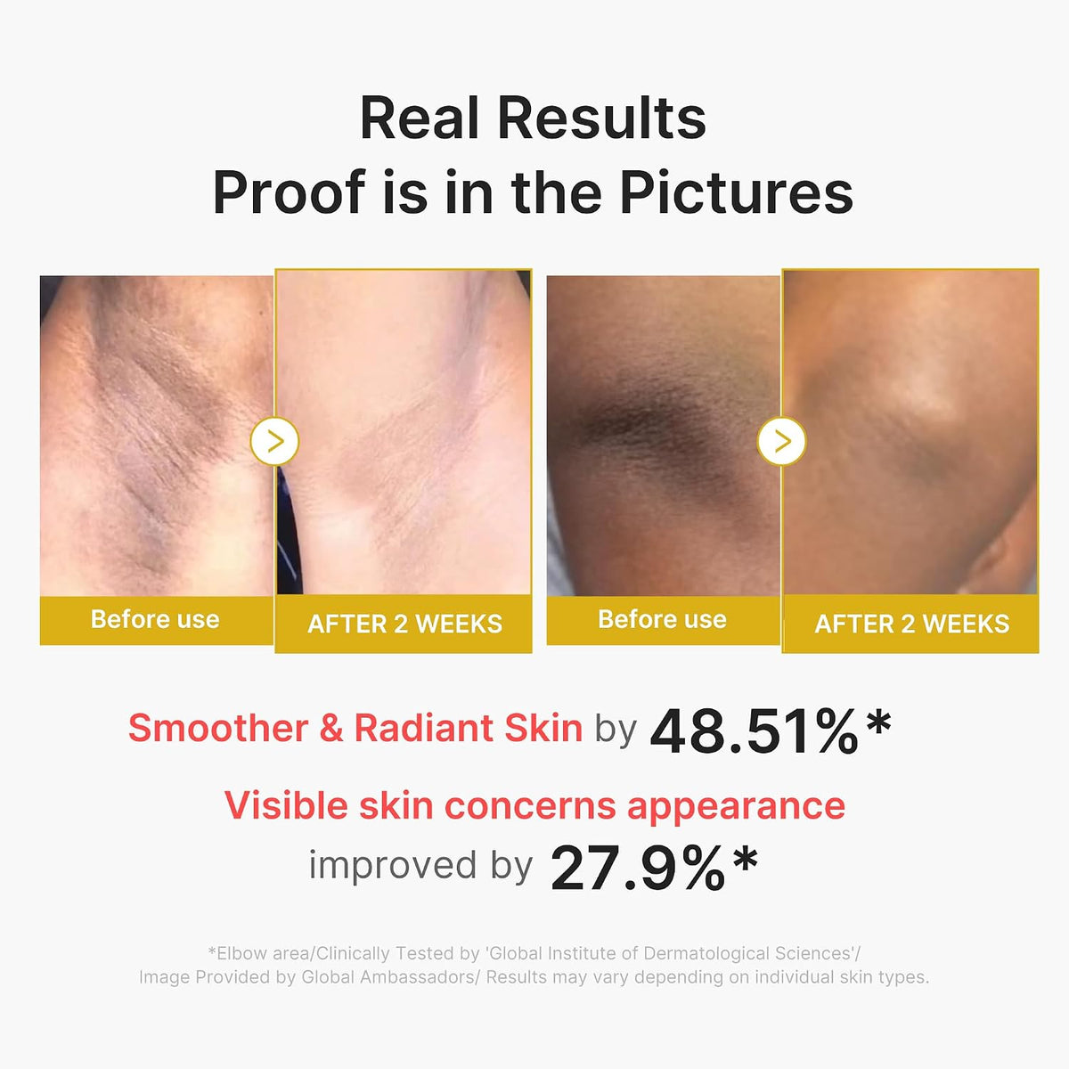 medicube Dual Body Peel Shot Duo Hypochlorous Acid and Turmeric Body Peel Shot for Gentle Exfoliation for Dead Skin Cells Rough